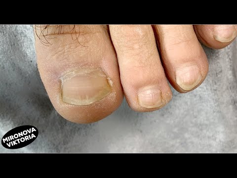 Видео: Мужской педикюр. Обработка стопы.