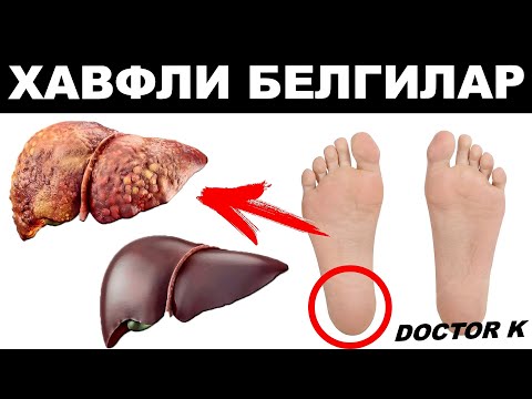 Видео: ЖИГАРИНГИЗ КАСАЛ ХАҚИДА ЎТА ХАВФЛИ БЕЛГИЛАР! ОГОХ БЎЛИНГ!!!