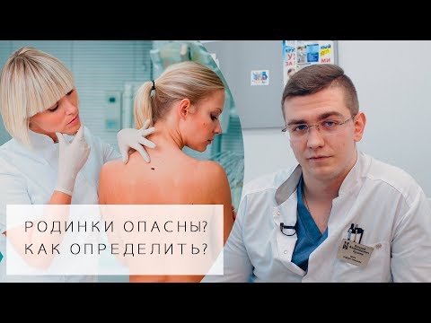 Видео: РОДИНКИ ОПАСНЫ? | 5 Простых способов определения | Какие родинки опасны?
