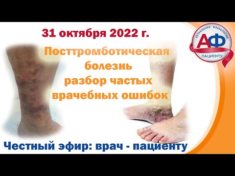 Видео: Посттромботическая болезнь = что происходит после тромбоза глубоких вен