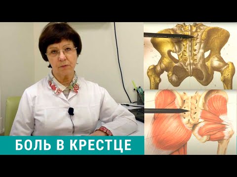 Видео: Боль в копчике, боль в крестце - что делать? Причины и лечение боли в крестце