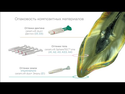 Видео: Комбинация композитов ceram.x ceram x SphereTEC one и ceram.x duo+ при реставрации фронтальных зубов