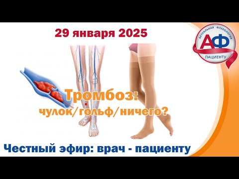 Видео: Тромбоз: чулок/гольф/ничего?