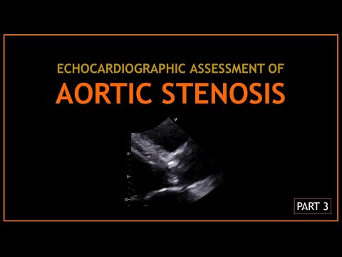 Видео: АОРТАЛЬНЫЙ СТЕНОЗ (Эхокардиографическая оценка) - ЧАСТЬ 3