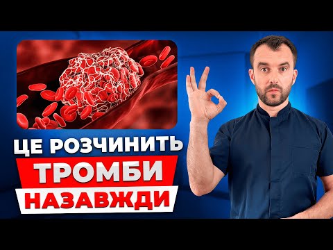 Видео: Як врятувати себе від тромбів? Зробіть це і тромби пройдуть назавжди