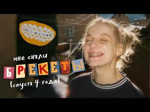 Видео: всё, что вам нужно знать о брекетах / ЦЕНА, БОЛЬ, ОГРАНИЧЕНИЯ и мой опыт