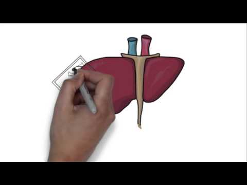 Видео: Печеночная энцефалопатия