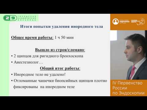 Видео: Бужирование рубцового стеноза и удаление длительно существующего (28 лет) инородного тела трахеи