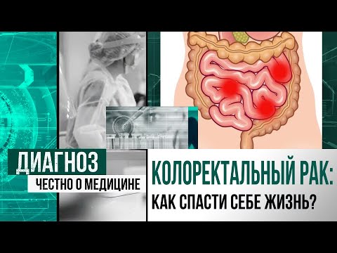 Видео: Жизнь без стомы: как при раке прямой кишки сохранить сфинктер | Диагноз