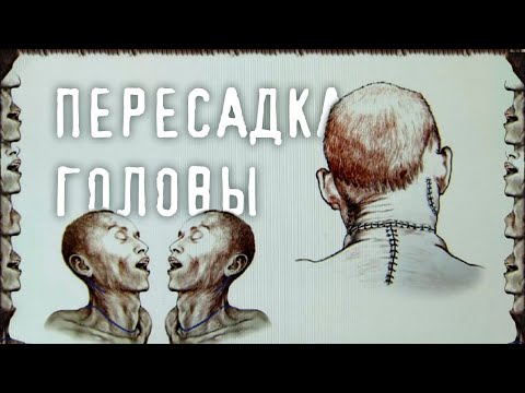 Видео: ПЕРЕСАДКА ГОЛОВЫ