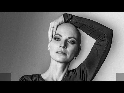 Видео: Как я теряла волосы после химии