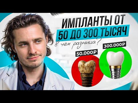 Видео: ТОП 3 лучших имплантов 2025! Какие реально ставят врачи?