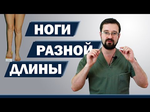 Видео: Разная длина ног? Косой таз? Проверяем себя дома и у врача