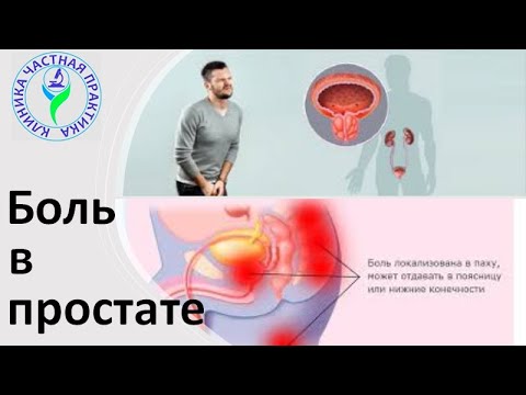 Видео: Боль в простате