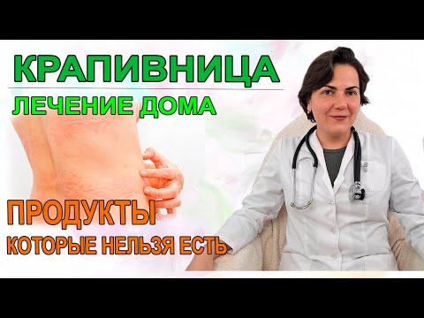 Видео: Крапивница, лечение в домашних условиях. Аллерголог Екатерина Екатерина Цывкина
