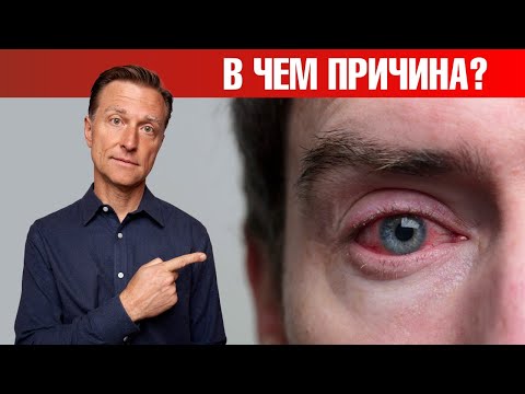 Видео: Красные глаза, зуд, чувствительность к свету 👉 главная причина!