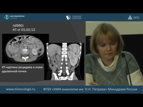 Видео: Клинико-рентгено-морфологическая дифференциальная диагностика опухолей почек в сложных случаях