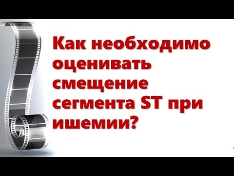 Видео: Смещение ST