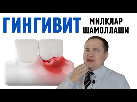 Видео: МИЛКЛАР ҚОНАШИ, ИССИҚ СОВУҚ СЕЗИБ ОҒРИШИ ГИНГИВИТ САБАБЛАРИ ВА УЙ ШАРОИТИДА ДАВОЛАШ ХАКИДА ИСЧАНОВ