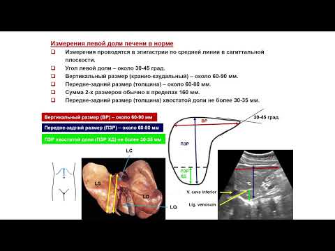 Видео: Ультразвуковая диагностика (УЗИ). Доктор Иогансен. Выпуск 8. Методика УЗИ печени.