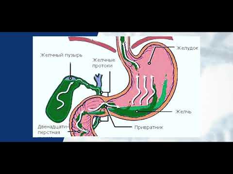 Видео: Пищевод Барретта (причины, диагностика, лечение)