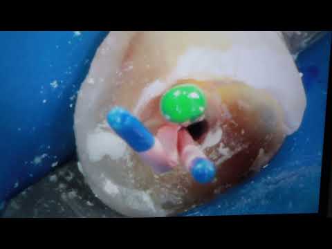 Видео: СТОМБУДНИ#23. САМАЯ БЫСТРАЯ КОРОНКА!