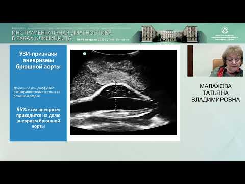 Видео: Ультразвуковое исследование в ургентных ситуациях у постели больного: на что нужно обратить внимание