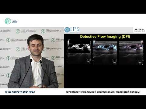 Видео: Три ключа к достоверному заключению при ультразвуковом исследовании молочной железы