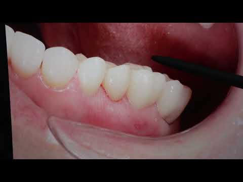 Видео: СТОМБУДНИ#22. Можно было сделать и по-другому
