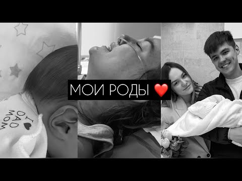 Видео: МОИ РОДЫ | без эпидуралки | истинный узел пуповины | эпизиотомия