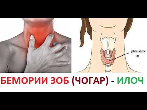 Видео: #ЗОБ_БЕМОРИИ_ЧОГАР_ТАБОБАТ_МЕШАВАД_ИНШАЛЛОХ,#