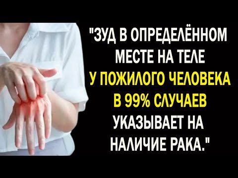 Видео: Зудящий участок кожи у пожилых может свидетельствовать о 99% риске рака — симптомы, которые покажут