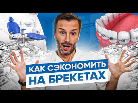 Видео: Брекеты и как на этом можно сэкономить – 5 способов. Это не повлияет на результат!