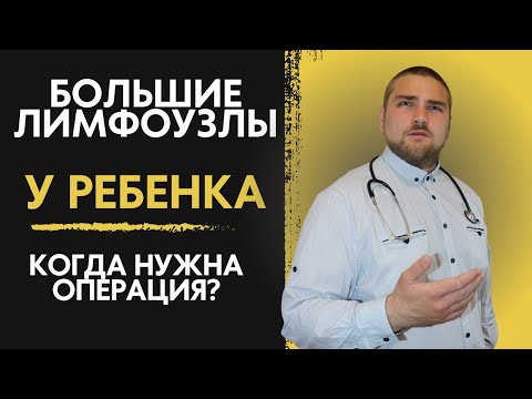 Видео: Большие лимфоузлы у ребенка | Что делать? | Лимфаденит и лимфаденопатия | Лечение