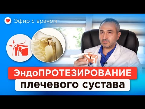 Видео: Избавьтесь от боли в плече! Эндопротезирование плечевого сустава бесплатно по ОМС