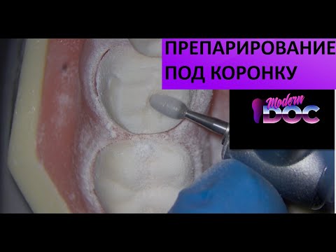 Видео: ПРЕПАРИРОВАНИЕ ПОД ПОЛНУЮ КОРОНКУ(подробная инструкция)