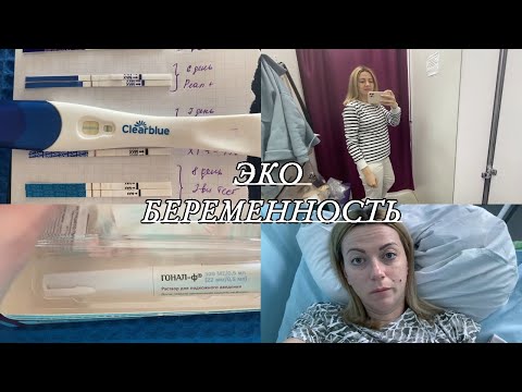 Видео: VLOG: ЭКО БЕРЕМЕННОСТЬ с 1 ДПП/ Полосатые ТеЕСТЫ/ ХГЧ/ГИПЕРСТИМУЛЯЦИЯ/Первый СКРИНИНГ/САМОЧУВСТВИЕ