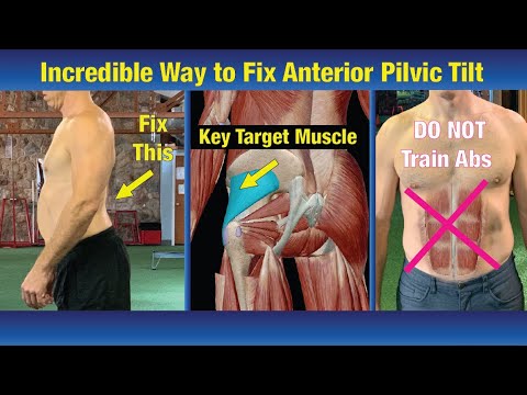 Видео: НЕВЕРОЯТНЫЙ способ исправления переднего наклона таза — НИКОГДА РАНЕЕ невиданное упражнение!