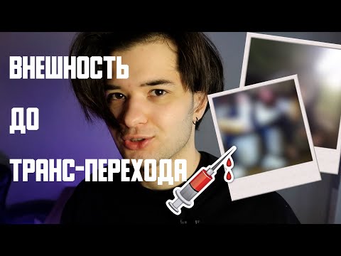 Видео: Мои фото до гормонотерапии! FtM / ФтМ