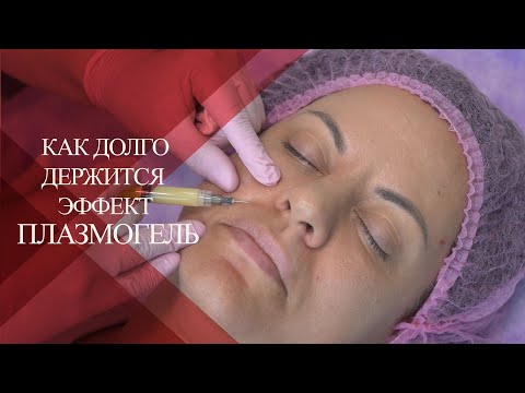 Видео: 💉Контурная пластика ПЛАЗМОГЕЛЬ  | Как долго держится ЭФФЕКТ от PLASMOGEL