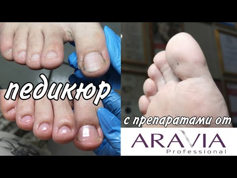 Видео: Мужской педикюр с препаратами Aravia ч.2. Пенка жидкий педикюр, регенерирующий крем и очищающий гель