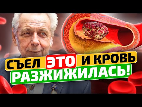 Видео: Неумывакин: Разжижать кровь ПРОСТО! Густая кровь, что делать?