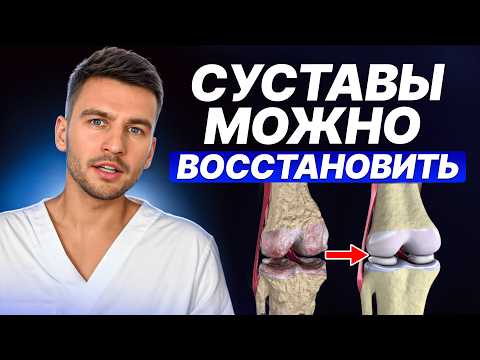 Видео: Об этом НЕ ГОВОРЯТ врачи! ВСЕ способы ЛЕЧЕНИЯ артроза: что работает, а что тратит деньги и время?