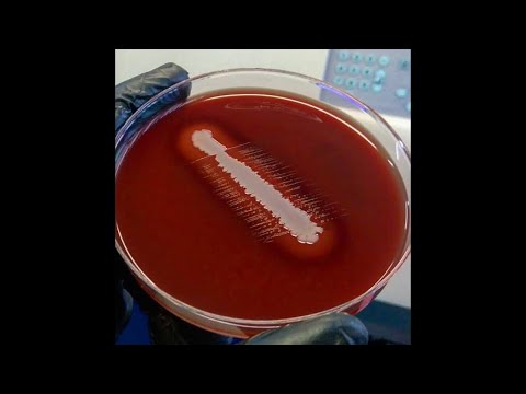 Видео: Haemophilus. Candida parapsilosis. Пятничные кейсы!