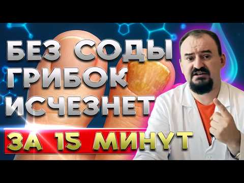 Видео: Как вылечить грибок ногтей быстро и навсегда - 100% метод