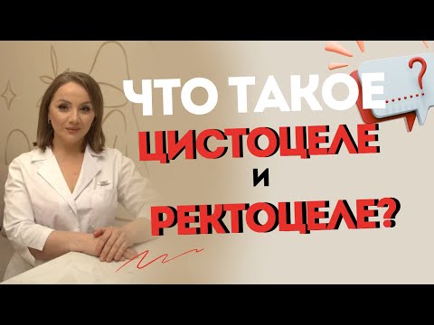 Видео: Что такое цистоцеле и ректоцеле?