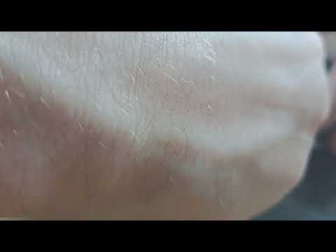 Видео: замена  акб Poco x3 nfc