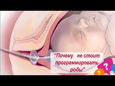 Видео: ПОДКАСТ ПРО РОДЫ . - "Почему не стоит стимулировать роды в 40 недель"