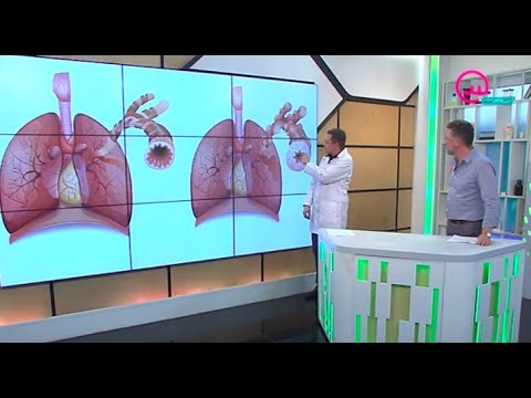 Видео: Доктор знает! Бронхиальная астма | Телеканал "Открытый мир. Здоровье"