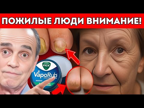 Видео: Скрытый Секрет Vick’s VapoRub, О Котором Никто Тебе Не Рассказал | Доктор Франк Суарес
